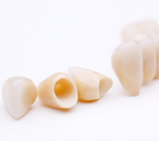 Snellville Dental Crowns and Dental Bridges