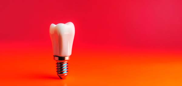 How To Protect Your Dental Implants