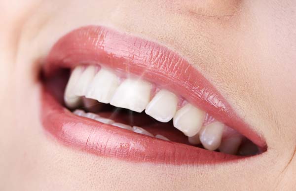 How Dental Veneers Can Strengthen Your Teeth