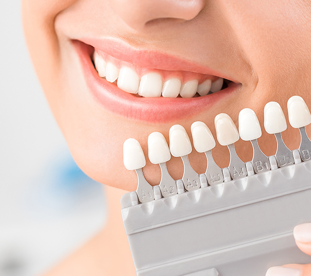 Snellville Dental Veneers and Dental Laminates