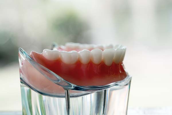 When Denture Repair May Require You To Send Them To A Lab