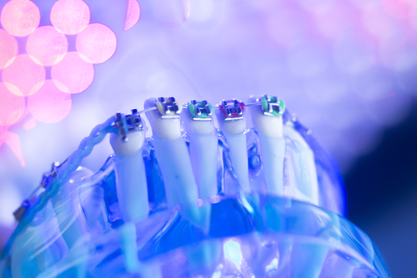 What Are Alternative Forms Of Teeth Straightening?