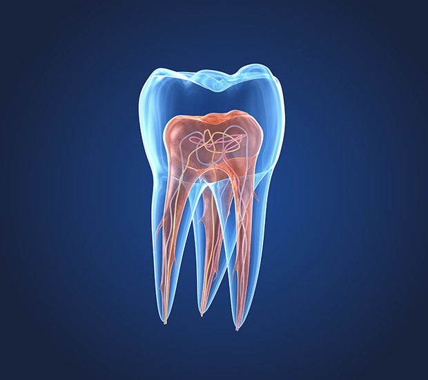 Snellville What is an Endodontist